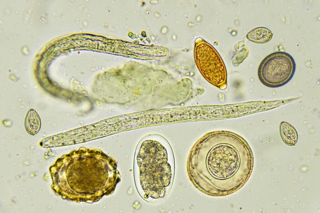 Wormen en wormeneitjes zijn zichtbaar onder een microscoop wormen wormeneitjes microscoop