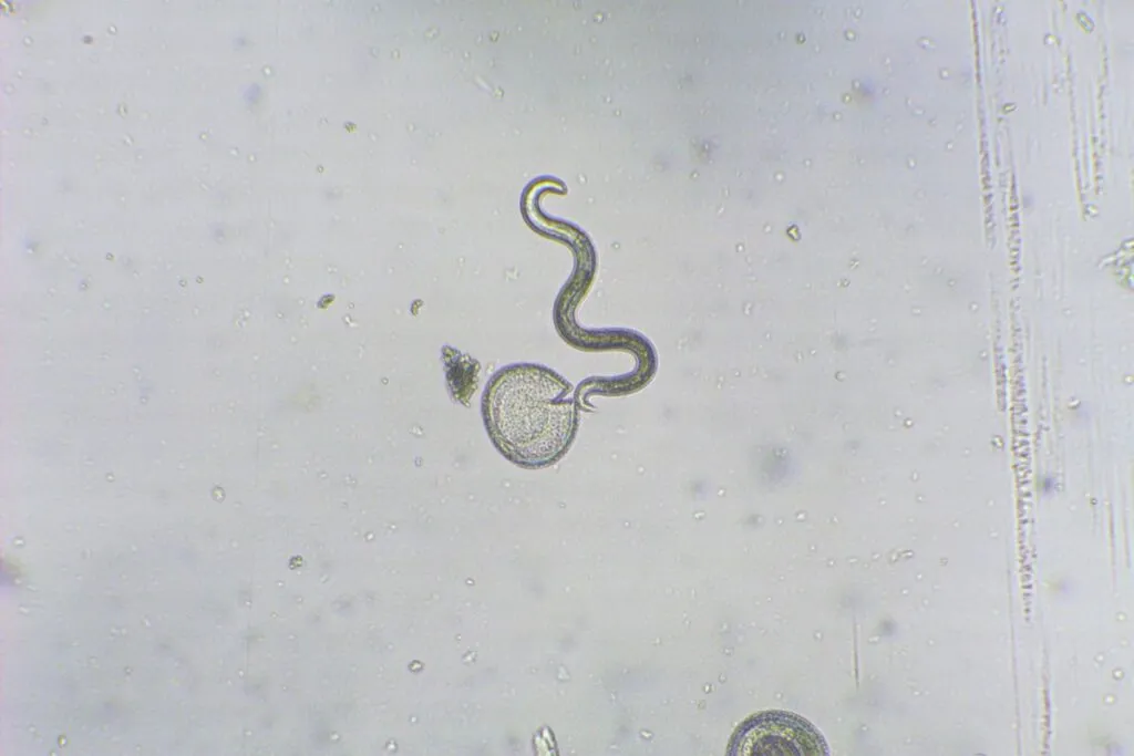 Microscopisch beeld van eieren en larven van spoelwormen.
