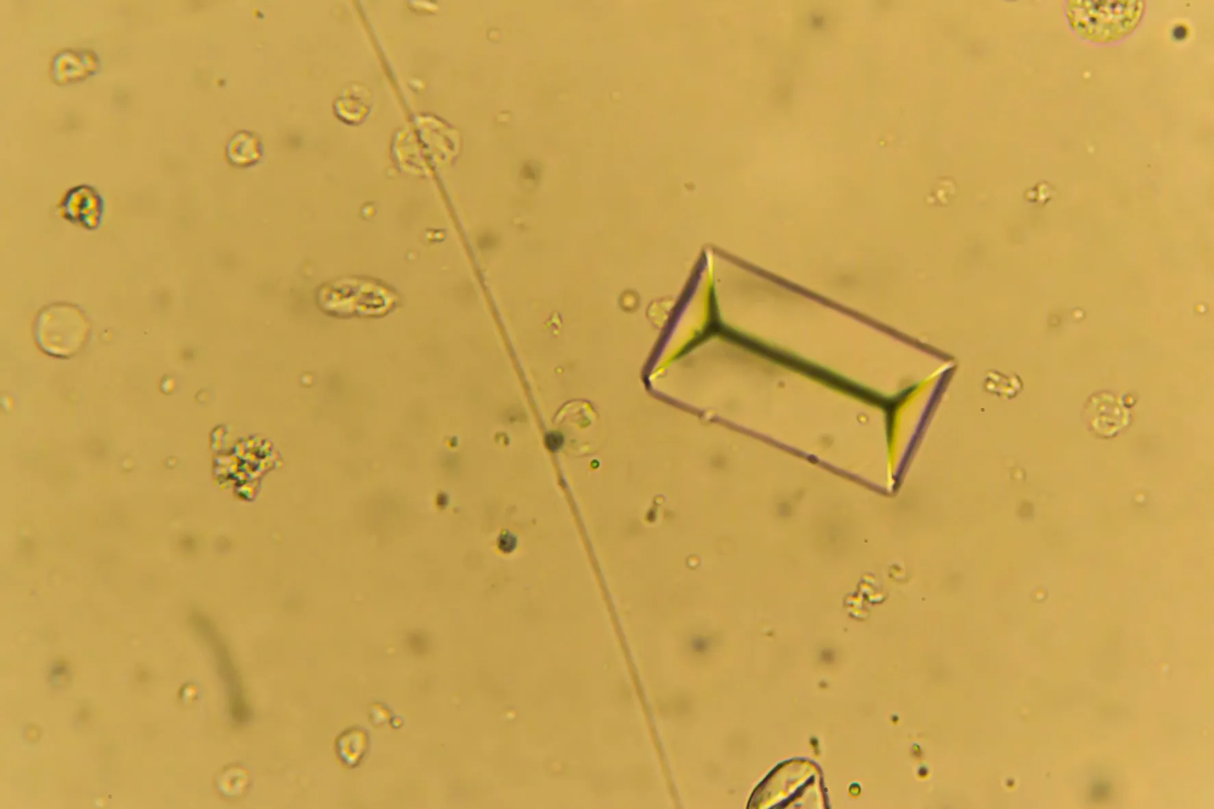 Struvietkristallen onder de microscoop bij de hond